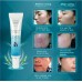 XI FEI SHI Acne Pimple Cream эффективный крем для удаления угрей и шрамов. 35мл.